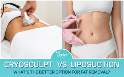 CryoSculpt vs. Traditional Liposuction: What’s the Better Option for Fat Removal?